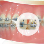 Dr. Gagan Bhalla Orthodontist Mississauga Canada