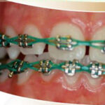 Dr. Gagan Bhalla Orthodontist Mississauga Canada