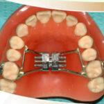 Dr. Gagan Bhalla Orthodontist Mississauga Canada