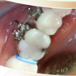 Dr. Gagan Bhalla Orthodontist Mississauga Canada