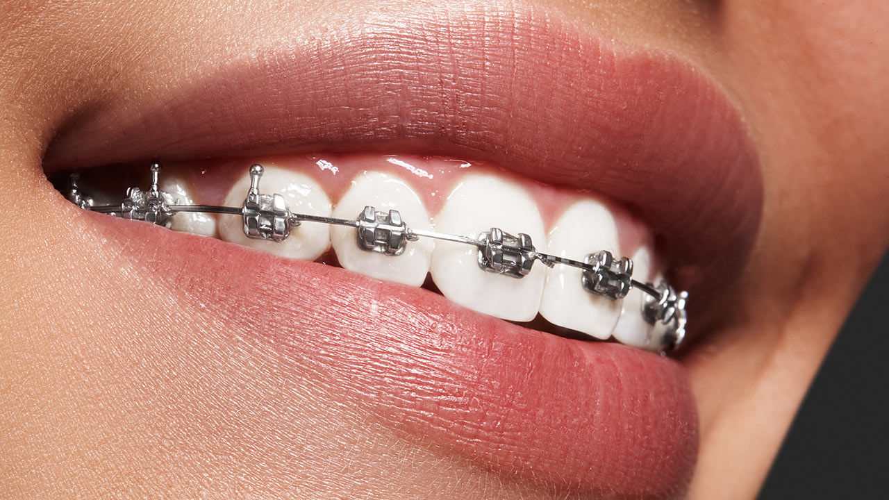 Dr. Gagan Bhalla Orthodontist Mississauga