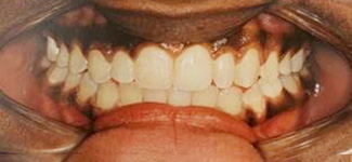 Orthodontic and Dentofacial Before & After Photos