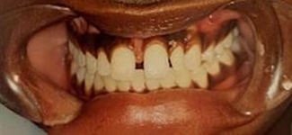 Orthodontic and Dentofacial Before & After Photos