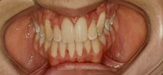 Orthodontic and Dentofacial Before & After Photos