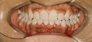 Orthodontic and Dentofacial Before & After Photos