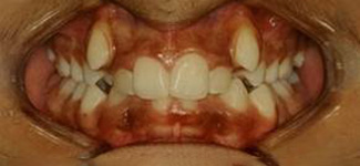 Orthodontic and Dentofacial Before & After Photos