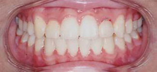 Orthodontic and Dentofacial Before & After Photos