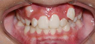 Orthodontic and Dentofacial Before & After Photos