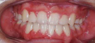 Orthodontic and Dentofacial Before & After Photos