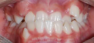 Orthodontic and Dentofacial Before & After Photos