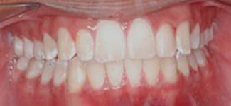 Orthodontic and Dentofacial Before & After Photos