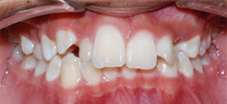 Orthodontic and Dentofacial Before & After Photos