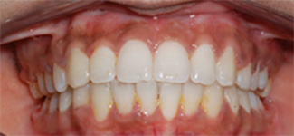 Orthodontic and Dentofacial Before & After Photos