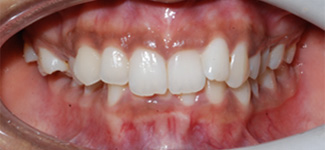Orthodontic and Dentofacial Before & After Photos