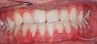 Orthodontic and Dentofacial Before & After Photos