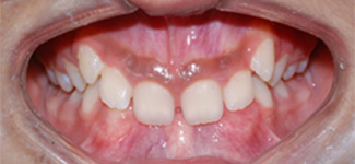 Orthodontic and Dentofacial Before & After Photos