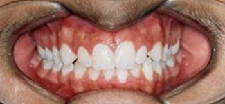 Orthodontic and Dentofacial Before & After Photos