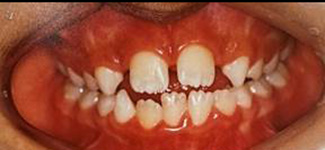 Orthodontic and Dentofacial Before & After Photos