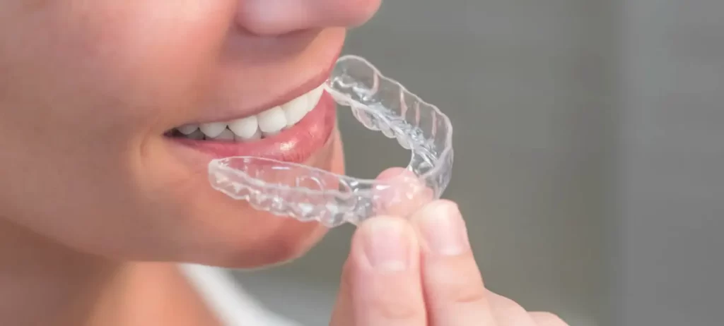 Invisalign treatment